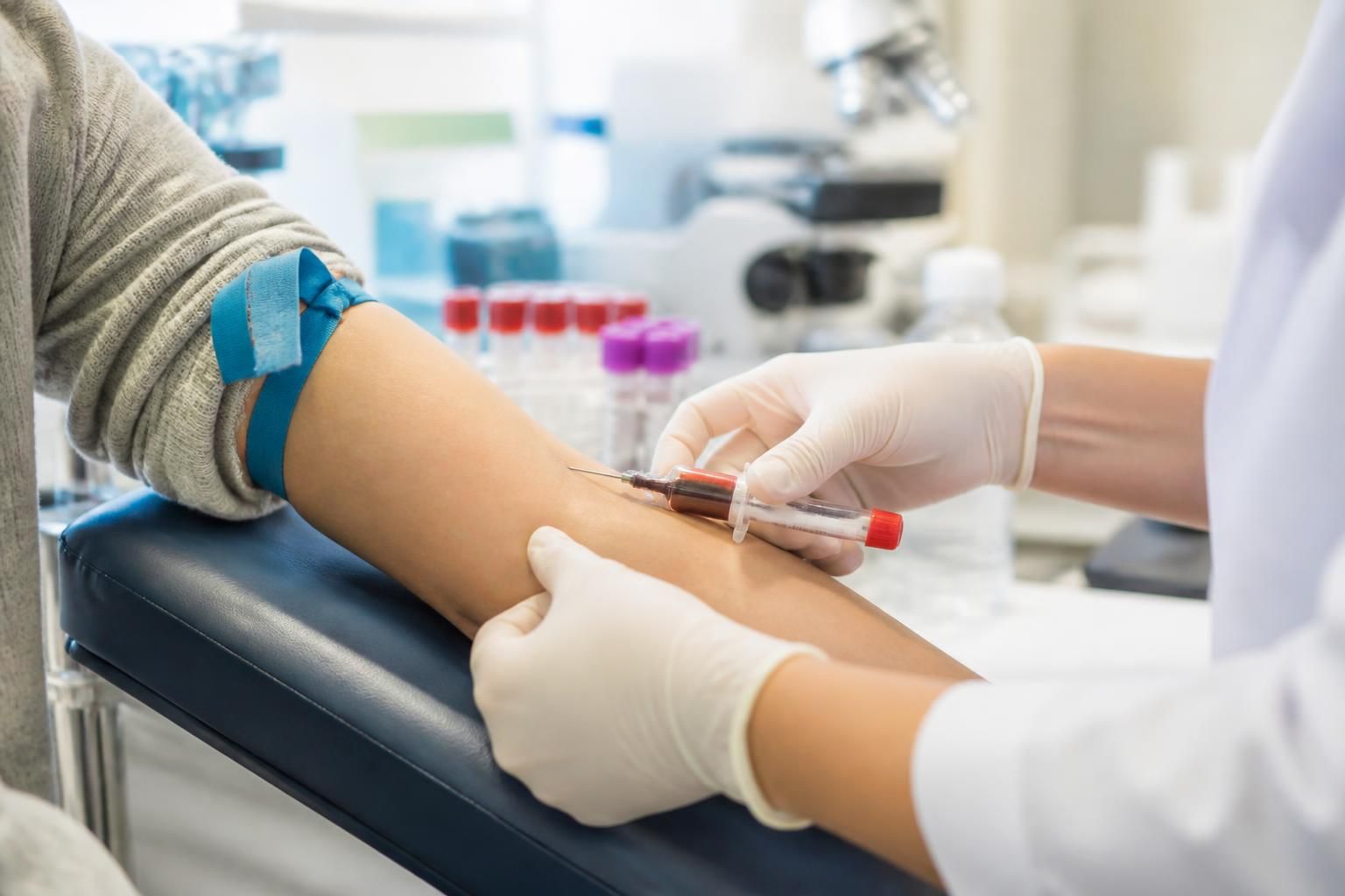 Prise de sang CMV : à quoi sert ce dépistage et quand le faire 9 découvrez l'importance de la prise de sang cmv, son utilité pour le dépistage du cytomégalovirus, et le moment idéal pour réaliser ce test.